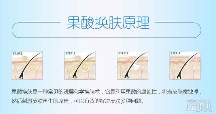 案例图片