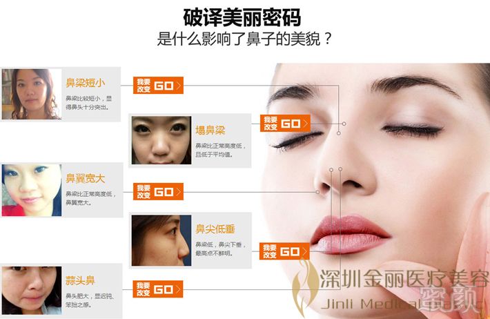 https://img.yiyiaimei.com/mnt/timg/170728/150U62T1-0.jpg