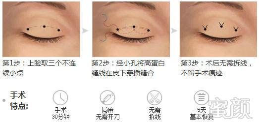 https://img.yiyiaimei.com/mnt/timg/170802/141KQ617-4.jpg