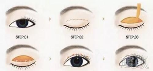 https://img.yiyiaimei.com/mnt/timg/170802/141KS2N-2.jpg