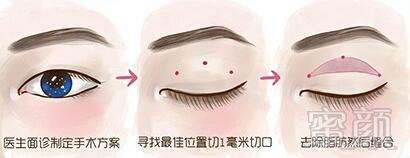 https://img.yiyiaimei.com/mnt/timg/170802/141KV132-3.jpg