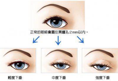 https://img.yiyiaimei.com/mnt/timg/170802/141KWF6-5.jpg