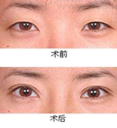 https://img.yiyiaimei.com/mnt/timg/170802/141KaW0-6.jpg