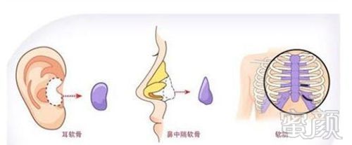 https://img.yiyiaimei.com/mnt/timg/170802/14314a5D-3.jpg