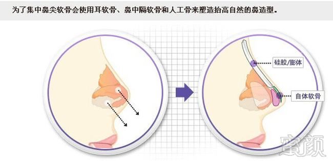https://img.yiyiaimei.com/mnt/timg/170802/1431502I7-4.jpg