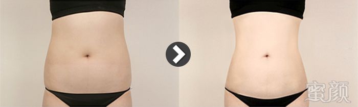 https://img.yiyiaimei.com/mnt/timg/170802/14463JE5-0.jpg