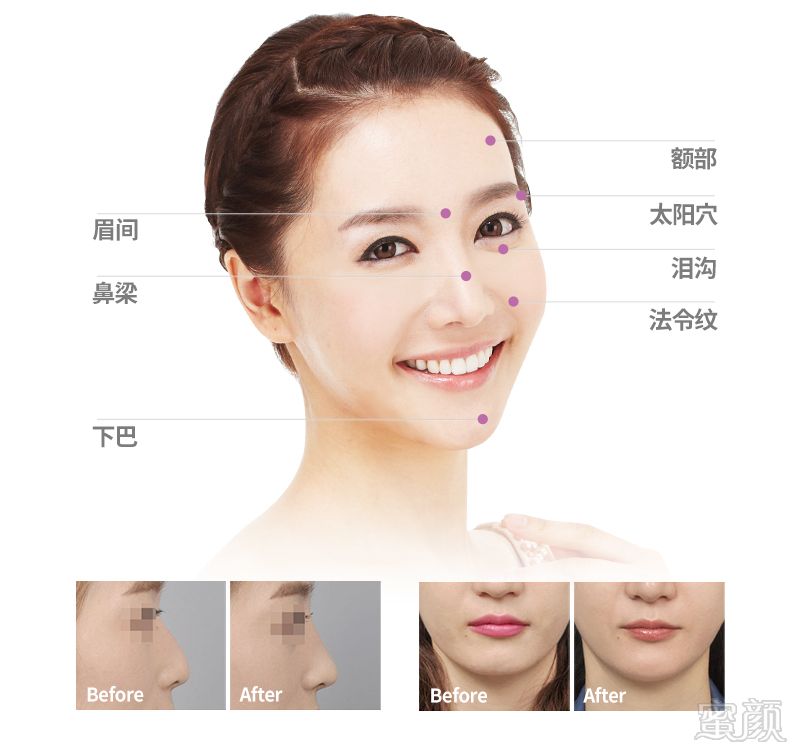 https://img.yiyiaimei.com/mnt/timg/170802/1500214954-7.jpg