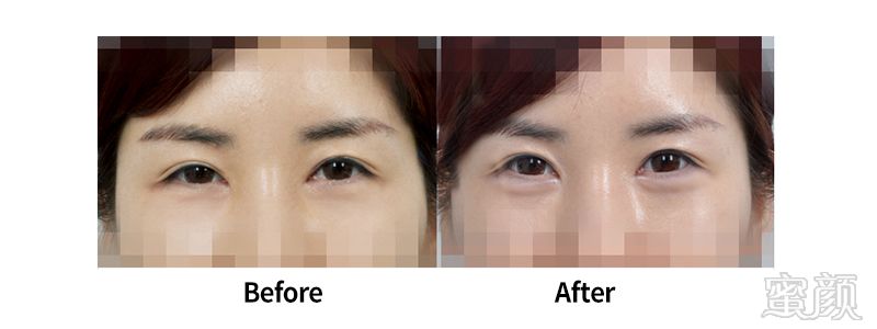 https://img.yiyiaimei.com/mnt/timg/170802/150023I32-8.jpg