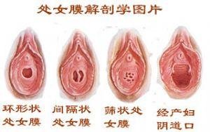 https://img.yiyiaimei.com/mnt/timg/170802/151Ua329-1.jpg