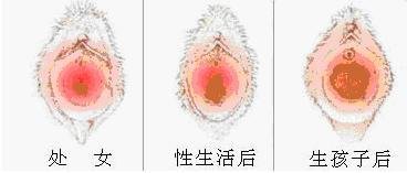 https://img.yiyiaimei.com/mnt/timg/170802/151UaF6-2.jpg