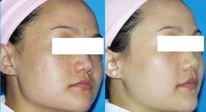 https://img.yiyiaimei.com/mnt/timg/170802/1S1222E8-1.jpg