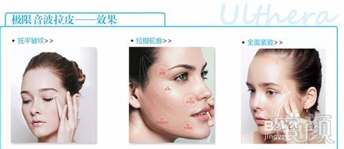 https://img.yiyiaimei.com/mnt/timg/170803/112K03551-0.jpg