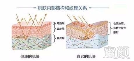 https://img.yiyiaimei.com/mnt/timg/170803/112K0B93-2.jpg
