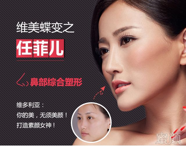 案例图片