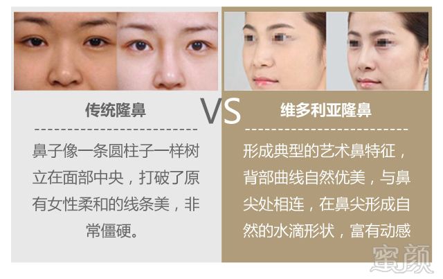 https://img.yiyiaimei.com/mnt/timg/170803/1314423227-2.jpg