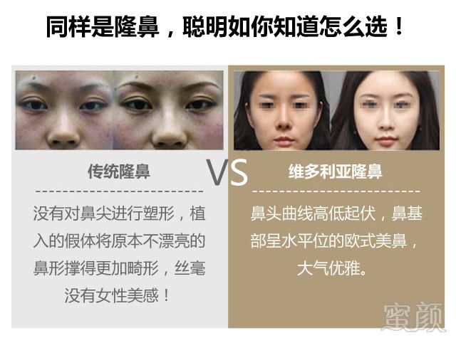 https://img.yiyiaimei.com/mnt/timg/170803/131442J15-1.jpg