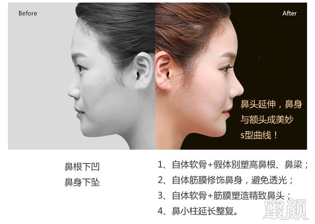 https://img.yiyiaimei.com/mnt/timg/170803/131443K92-4.jpg