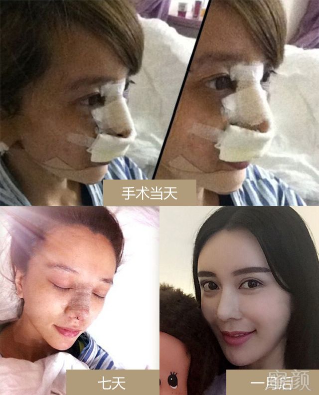 https://img.yiyiaimei.com/mnt/timg/170803/131444HN-5.jpg