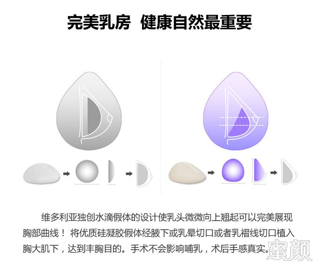 案例图片