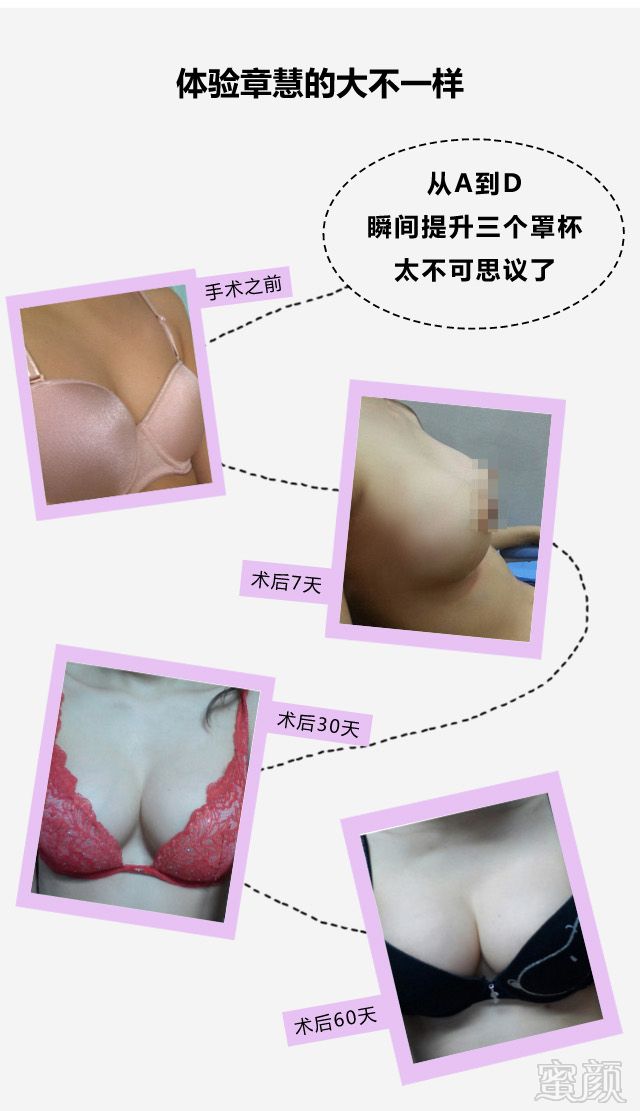 案例图片