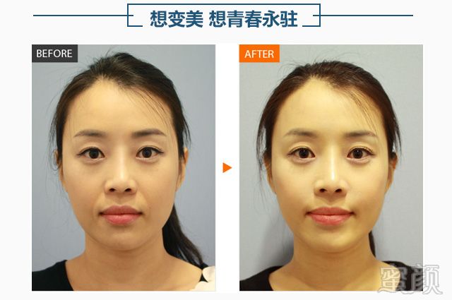 案例图片