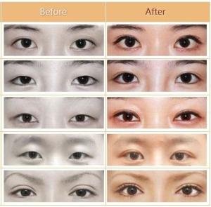 https://img.yiyiaimei.com/mnt/timg/170804/1454262301-0.jpg