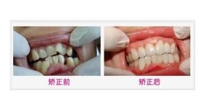 案例图片