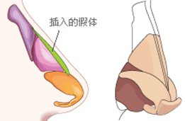 案例图片