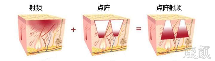 案例图片