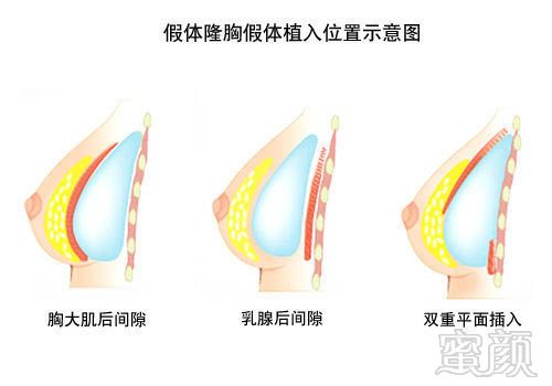 案例图片