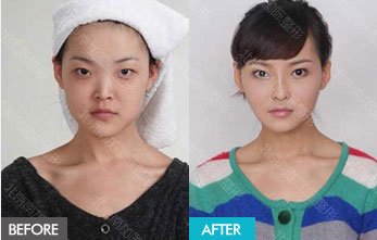 https://img.yiyiaimei.com/mnt/timg/170823/123J03Y3-8.jpg
