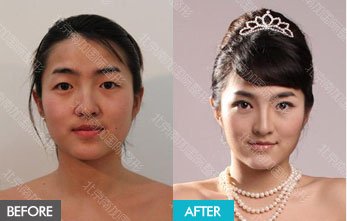 https://img.yiyiaimei.com/mnt/timg/170823/123J131c-10.jpg