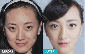 https://img.yiyiaimei.com/mnt/timg/170823/123J1I32-9.jpg