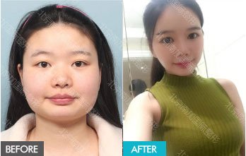 https://img.yiyiaimei.com/mnt/timg/170823/12453RV6-11.jpg