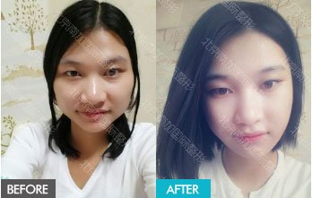 https://img.yiyiaimei.com/mnt/timg/170823/12453W411-9.jpg