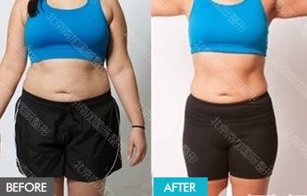 https://img.yiyiaimei.com/mnt/timg/170823/130451B91-14.jpg