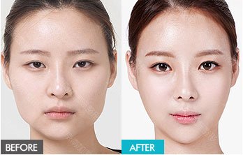 https://img.yiyiaimei.com/mnt/timg/170823/1346132c8-12.jpg