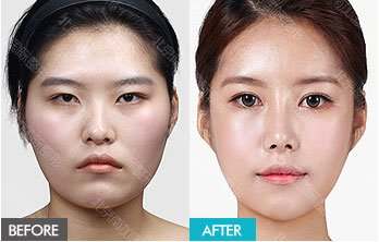 https://img.yiyiaimei.com/mnt/timg/170823/1346136448-13.jpg