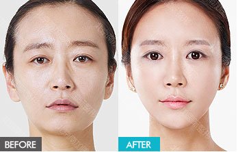 https://img.yiyiaimei.com/mnt/timg/170823/134614HT-14.jpg