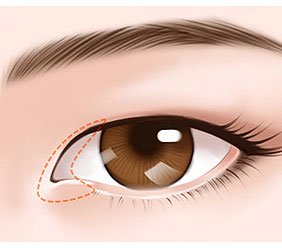 https://img.yiyiaimei.com/mnt/timg/170823/1351263L4-0.jpg