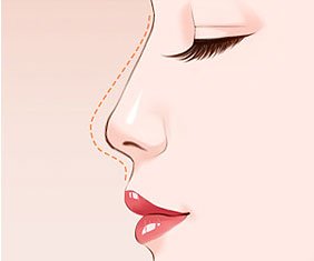 https://img.yiyiaimei.com/mnt/timg/170823/140A62624-0.jpg
