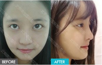 https://img.yiyiaimei.com/mnt/timg/170823/140A9C53-14.jpg