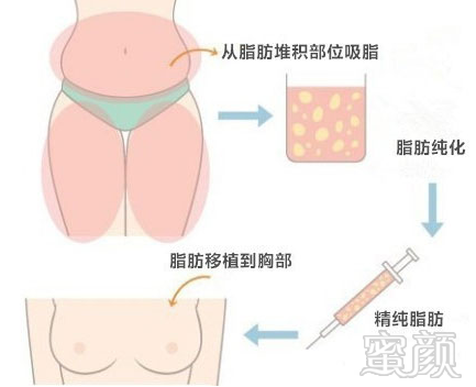 案例图片