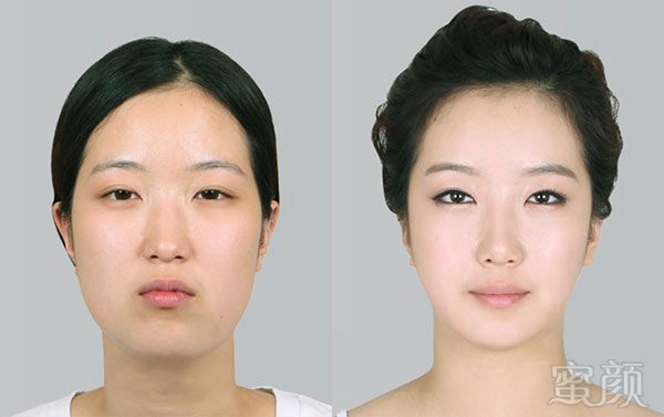 案例图片