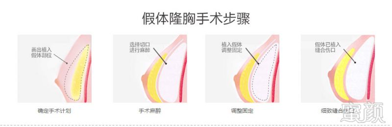 https://img.yiyiaimei.com/mnt/timg/170824/1455061F1-10.jpg