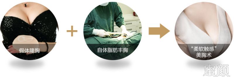 https://img.yiyiaimei.com/mnt/timg/170824/1455064R8-7.jpg