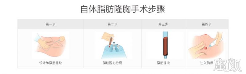 https://img.yiyiaimei.com/mnt/timg/170824/14550I0D-11.jpg