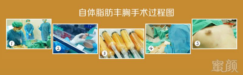 案例图片
