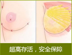 案例图片