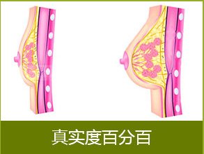 案例图片